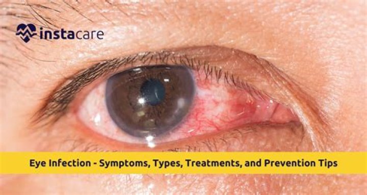 Can an eye infection affect your vision?
