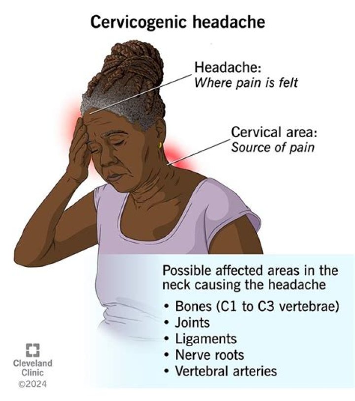 Can cerebrovascular cause headaches?