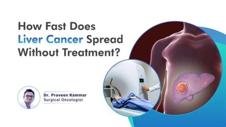 Can esophagus cancer spread to liver?