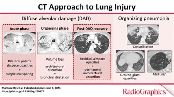 Can near drowning cause lung damage?