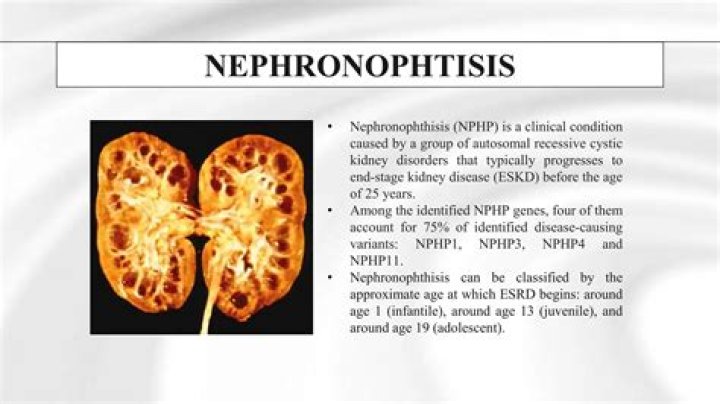Can Nephronophthisis be cured?