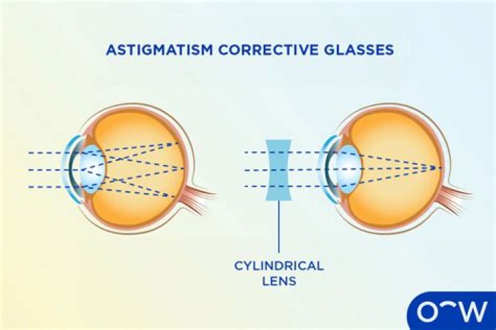 Can oblique astigmatism be corrected?