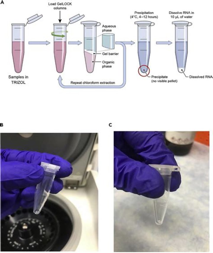 Can tissue be stored in TRIzol?