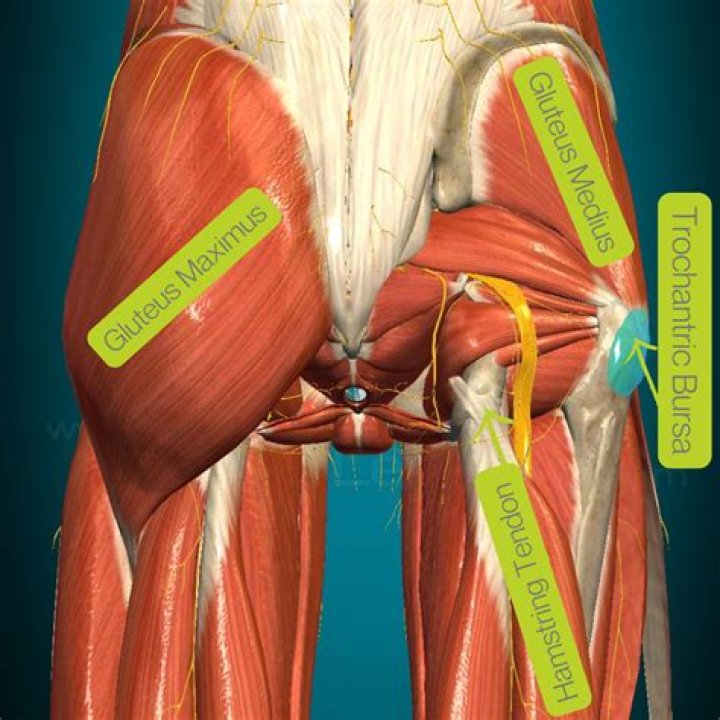 Can weak glutes cause IT band syndrome?