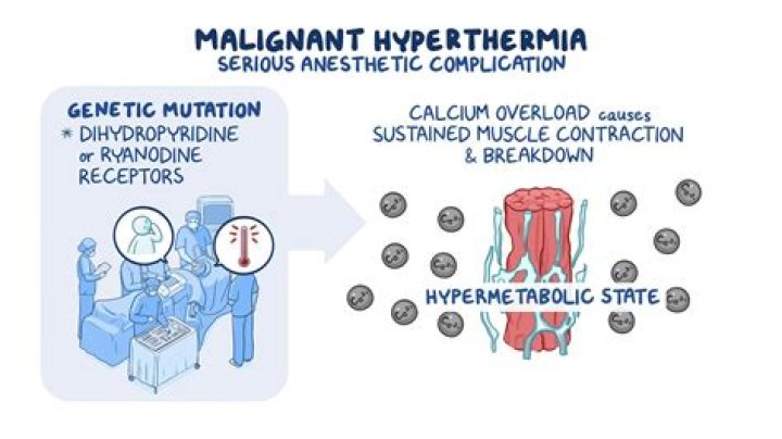 Can you have rhabdo and not know it?