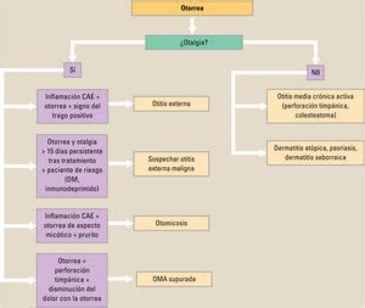 Cual es el origen de la otalgia?