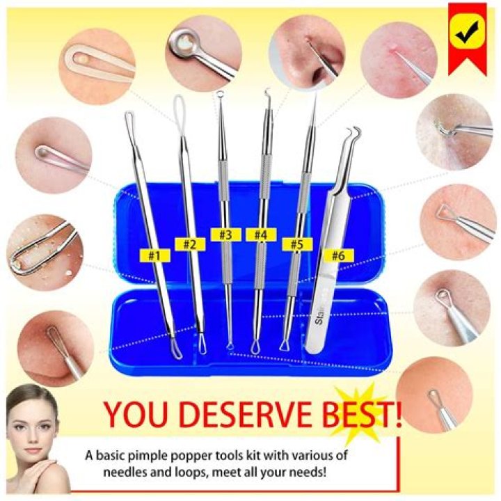 Do blackhead removal tools work?