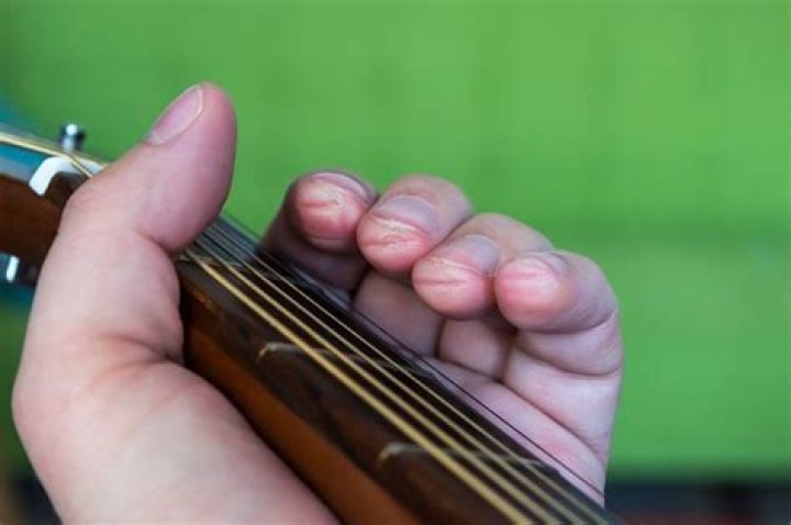 Do violinists get calluses on their fingers?