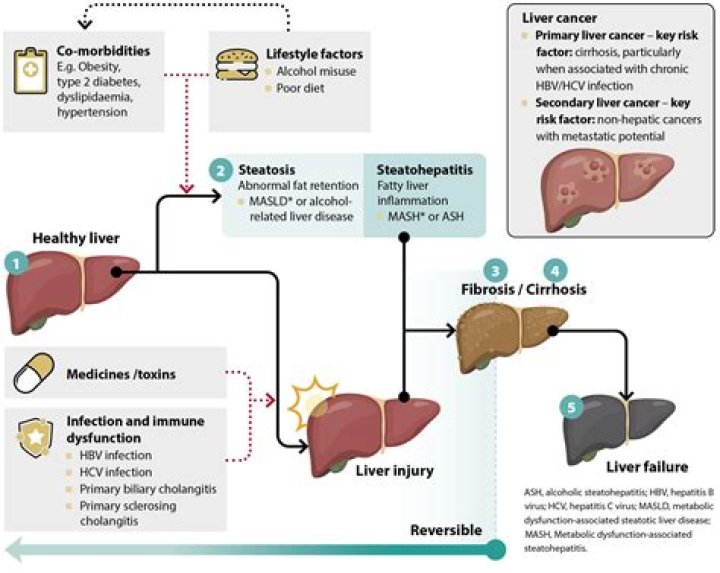 Does Gemzar affect the liver?