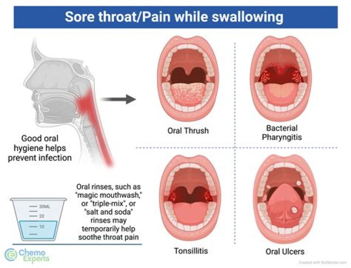 Does Omnaris cause sore throat?