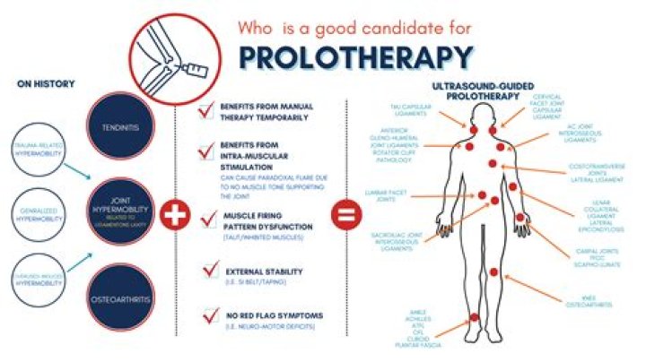 Does Prolotherapy work for cervical instability?