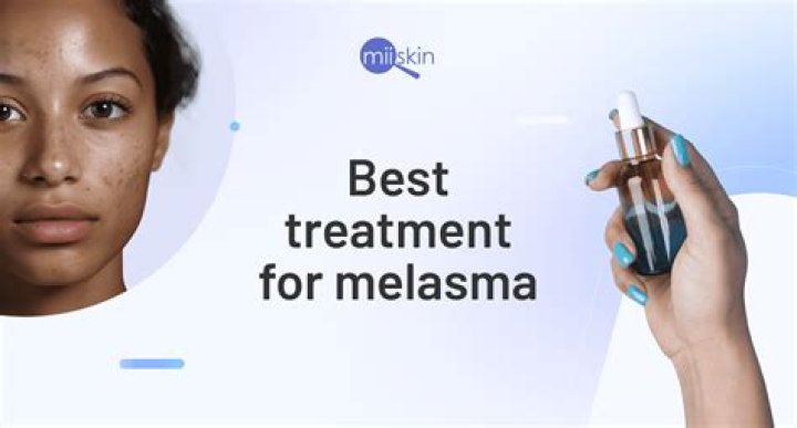 How can I permanently remove melasma?