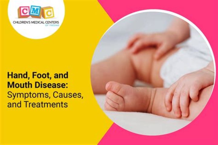 How can I speed up the healing process of hand foot and mouth?