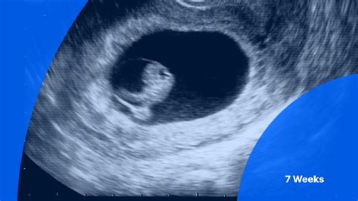 How do I know my baby is OK at 7 weeks?