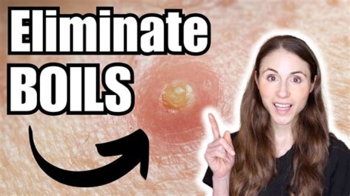 How do you get rid of hard boils under skin?