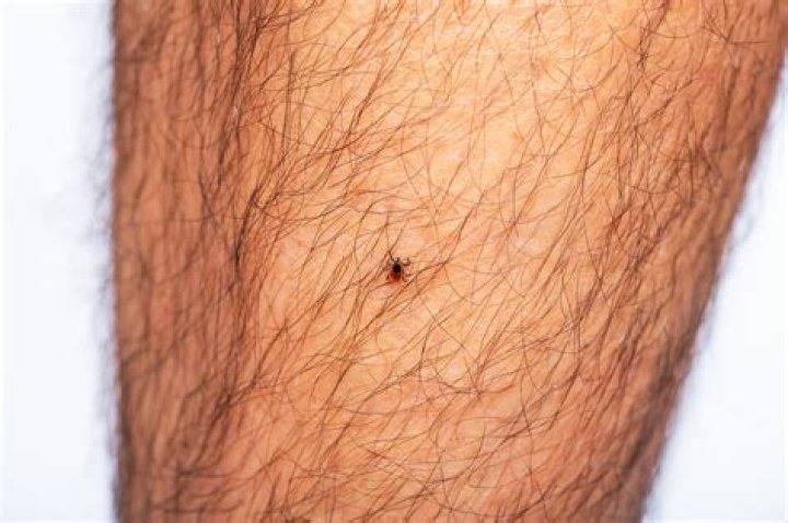 How do you type a tick in a box?