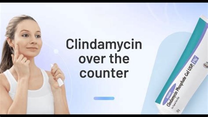 How do you use clindamycin 1% lotion?