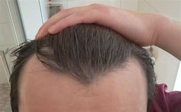 How far back does a hair test show?