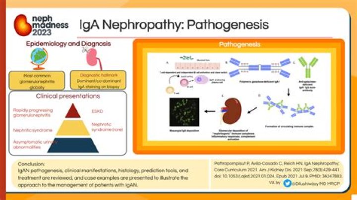 How is analgesic nephropathy diagnosed?