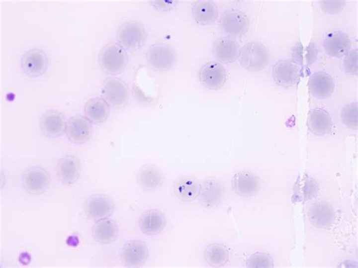 How is Haemobartonella treated?