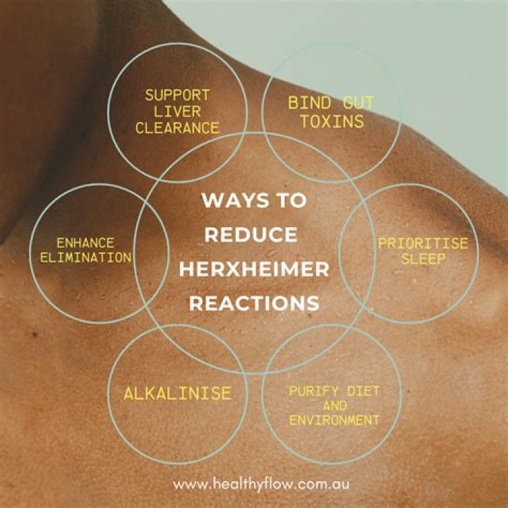 How long does herxheimer reaction last Lyme?