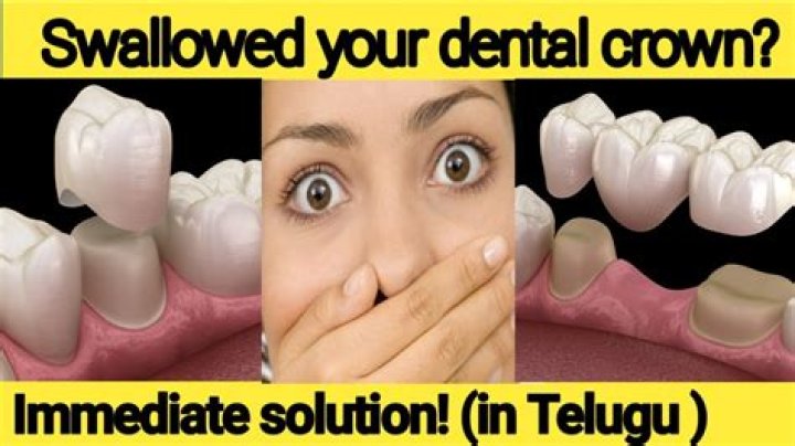 How long does it take to pass a swallowed tooth?