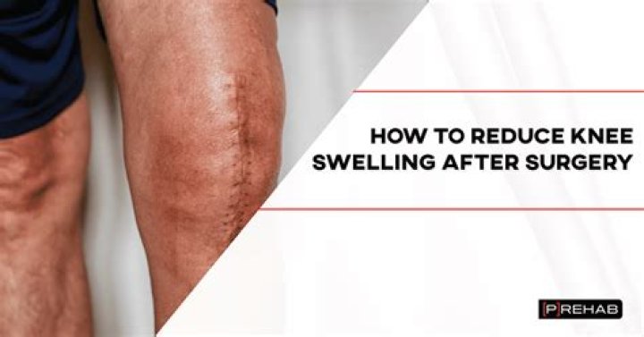 How long does swelling last after laser treatment?