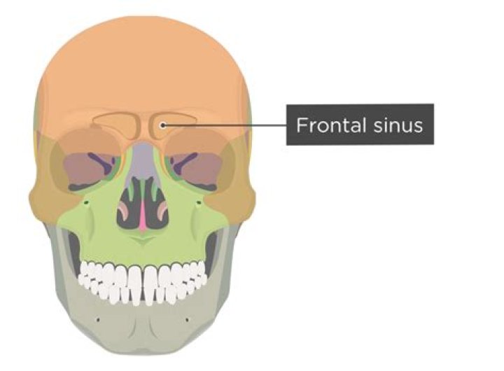 How rare is frontonasal dysplasia?