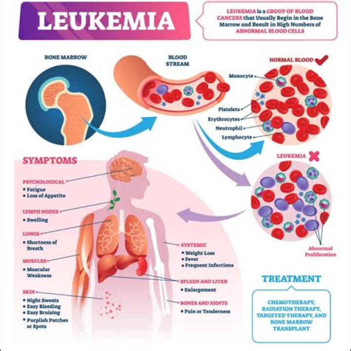 How was leukemia treated in the 60s?