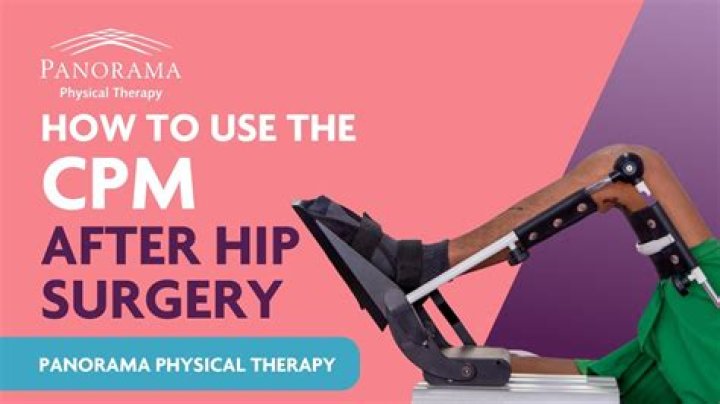 Is a CPM machine necessary after ACL surgery?