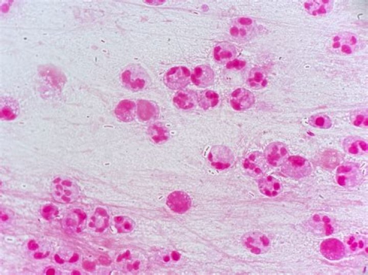 Is mycoplasma is wall less?