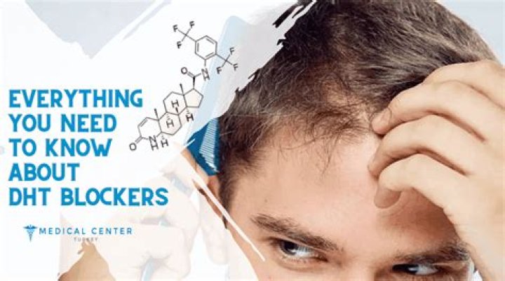 Is nettle extract a DHT blocker?