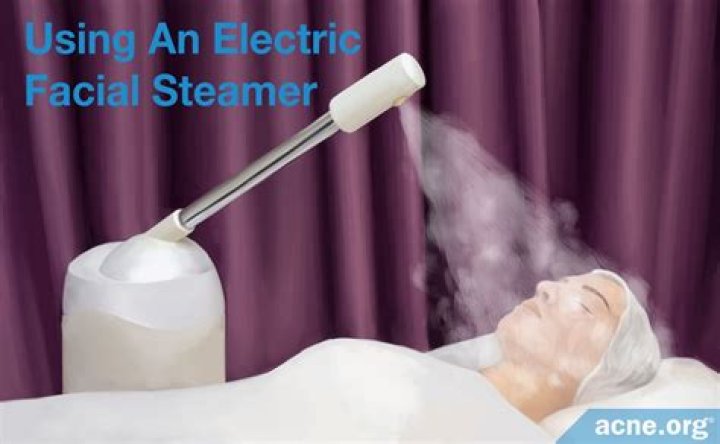 Is steaming good for acne?