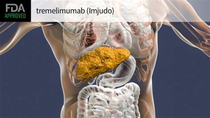 Is Tremelimumab approved?