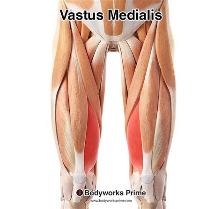 Is vastus medialis a quadriceps?