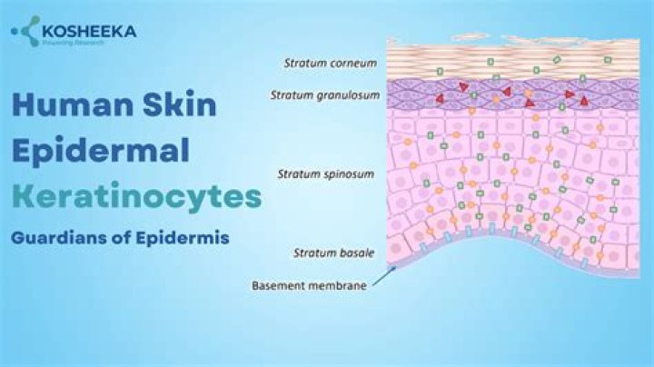 What are epidermal keratinocytes?