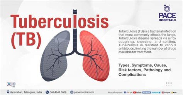 What are the 3 types of tuberculosis?