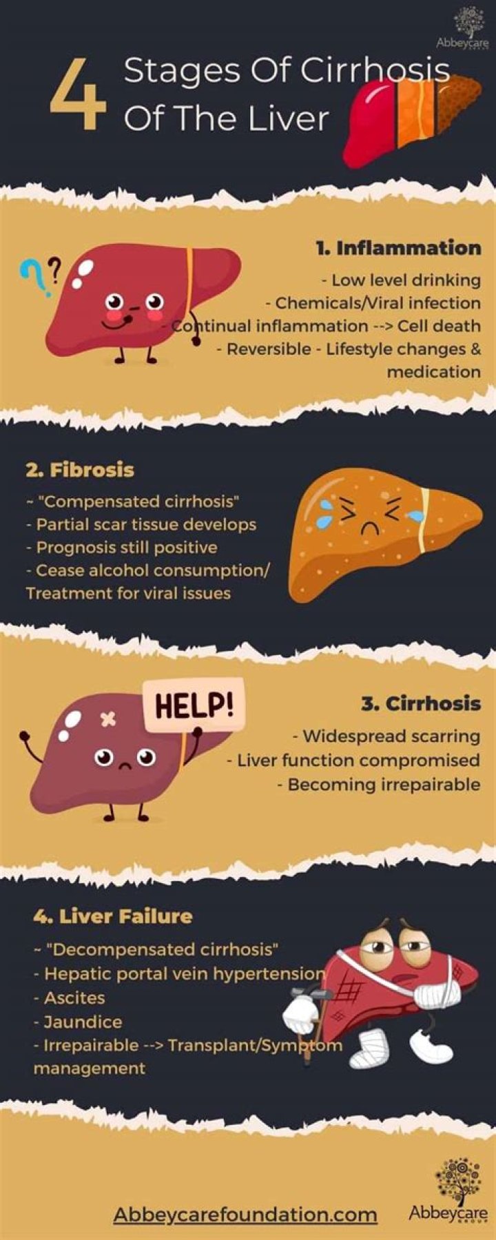 What are the 4 stages of cirrhosis of the liver?