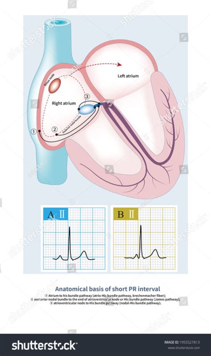 What area of the heart forms the PR segment on the ECG?