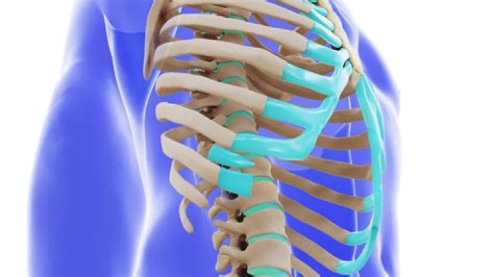 What causes 12th rib syndrome?