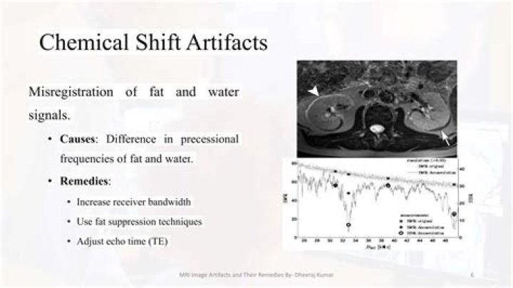 What causes chemical shift artifacts?