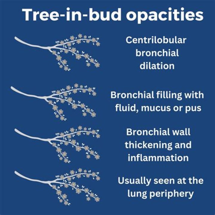 What causes tree-in-bud in lungs?