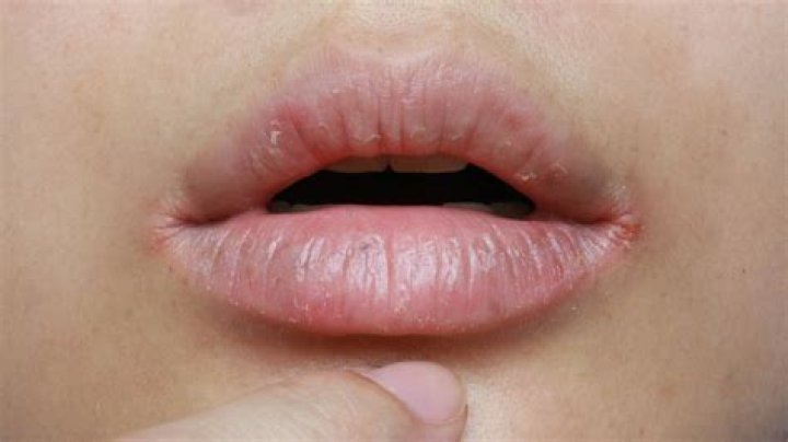What does it mean when its dry around your lips?