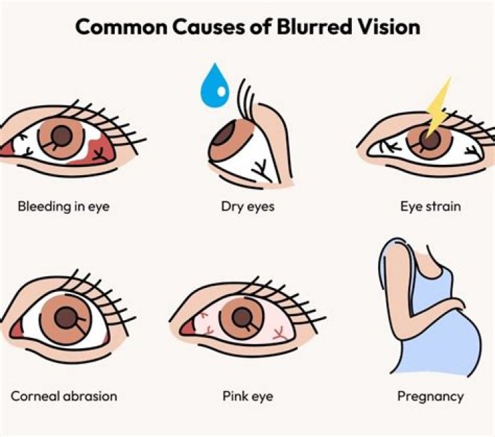 What does it mean when your vision is blurry during pregnancy?