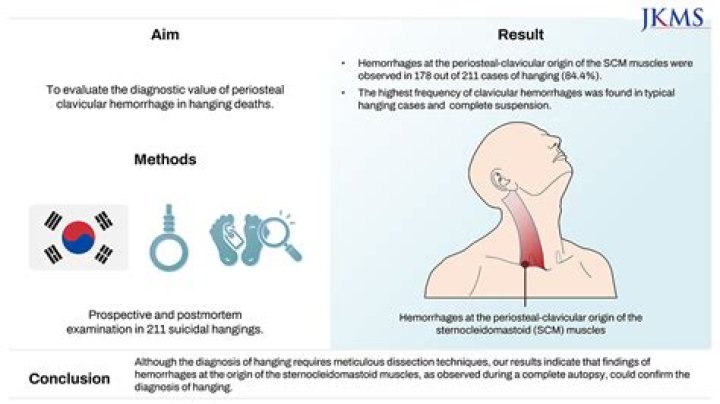 What does ligature mean in anatomy?
