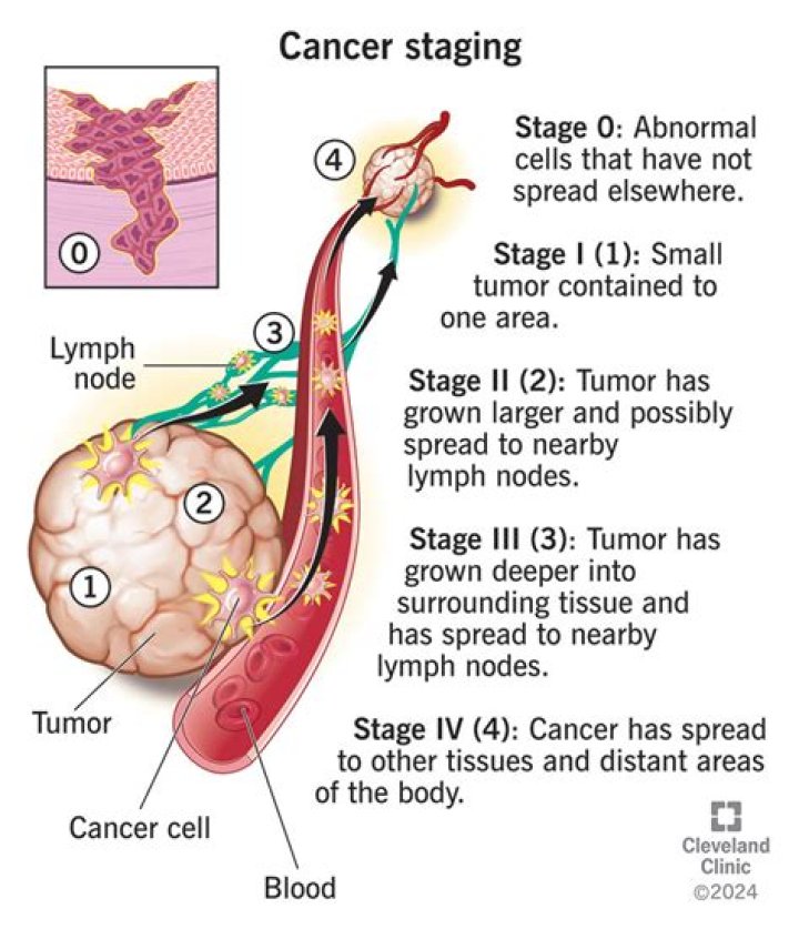 What does non terminal cancer mean?