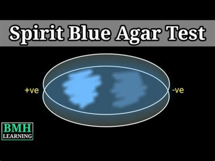 What does the spirit blue agar detect and why?