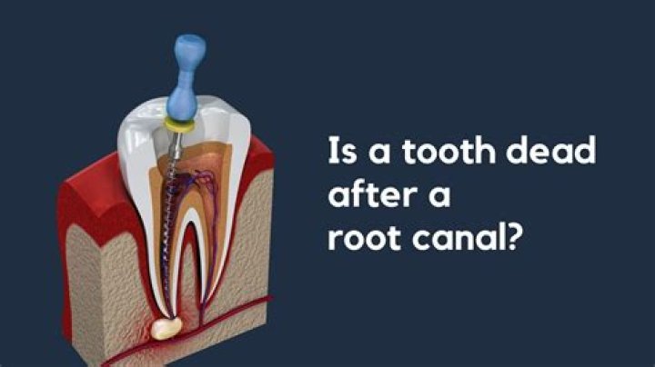 What happens when a tooth has no root?
