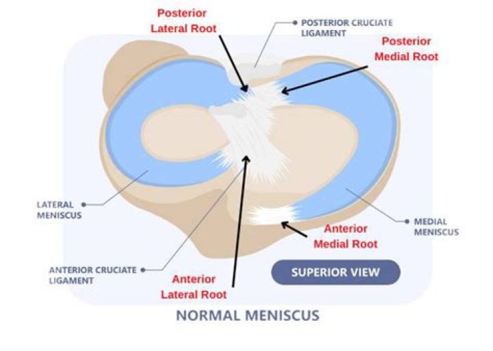 What is medial meniscus root repair?