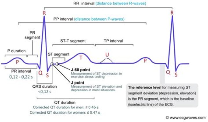 What is PR interval on ECG?